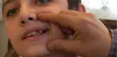 Süt Dişi Yerine Daimi Dişin Çekildiği İddiası