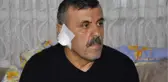 65 Bin liralık Alacağını İsteyince Kavga Çıktı, Talihsiz Adamın Kulağı Isırılarak Koparıldı