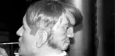 Kafasının Arkasında İkinci Bir Yüzü Olan ve Buna Dayanamayıp İntihar Eden Adam: Edward Mordake