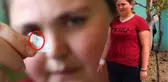 8 Yıl Önce Vücudundan 35 İğne Çıkarılan Genç Kızın Vücudu Yine İğne Üretmeye Başladı