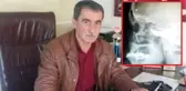 Kafasında Unutulan Kurşunla 40 Yıl Yaşadı: Ölürsem Şehit Olur muyum?