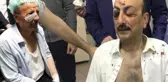 Ankara'da Saadet Partliler ile MHP'liler Arasında Sopalı Kavga Çıktı, Milletvekili Adayı Hastanelik Oldu