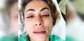 Tayland'da Sivri Sineğin Isırıp Hasta Ettiği Oyuncu Leyla Bilginel İstanbul'a Getirildi
