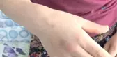 Damadı Tarafından Bıçaklanan Adam Dehşet Anlarını Anlattı