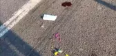 Motosikletin Çarptığı Çocuk Ağır Yaralandı