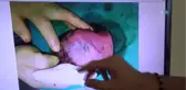Yeşil Sahaların Doktor Hakemi 3 Günlük Bebeği Hayata Bağladı