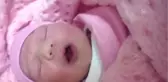 Dokuz Dişli Doğan Bebek Şaşırttı
