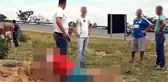 Genç Kadının Karnını Keserek, Bebeğini Çaldılar