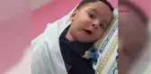 Sivas Sma Hastası Eymen Ali Bebek, Tedavi İçin Yardım Bekliyor