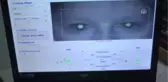 Göz Tembelliği Olan Kişilerin İş ve Ev Kazalarına Yatkınlığı Artıyor