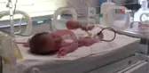Doğduktan 16 Saat Sonra Yapılan 