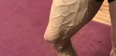 Bursasporlu Latovlevici'nin Bacağı Şaşkına Çevirdi