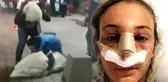 Sakar Damat Adayı, Evleneceği Kadını Kaçırmak İsterken Hastanelik Etti, Görüntüler Sosyal Medyayı Salladı