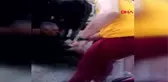 Osmaniye Kaldırımda Yürürken Pitbull Cinsi Köpeğin Saldırısına Uğradı