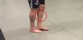 Beşiktaş'ın Şilili Oyuncusu Gary Medel'in Bacağı Delindi!
