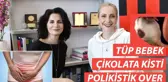 Tüp Bebek - Sıfır Spermle Hamile Kalınabilir mi - Çikolata Kisti | Sebile Ölmez