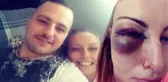 Aldatıldığını İddia Eden Cani, Kız Arkadaşını Öldüresiye Dövdü