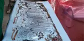 Karın ağrısıyla doktora giden Hintli kadının midesinden aksesuar, bozuk para ve kol saati çıktı