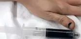 25 yaşındaki kadının kanı, içtiği ilaç yüzünden mavi renge döndü