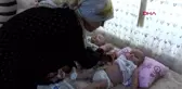 Ecrin bebek için sevindirici ameliyat olacak