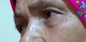 Çapa yaparken ısıran yılan hayatını kararttı