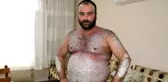 Vücudunun tamamı pullanan talihsiz adam, kimse korkmasın diye dışarı çıkmıyor