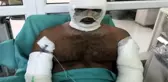Kebapçıda fırın patladı, iş yeri sahibi ağır yaralandı