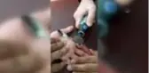 Parmağına sıkışan yüzüğü itfaiye ekipleri çıkarttı