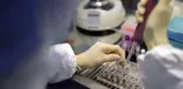 15 dakikada koronavirüs testi yapacak kit uygulamaya geçti
