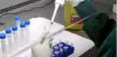 Erkeklerin koronavirüsten daha fazla etkilenmesinin nedeni kandaki bir enzim olabilir