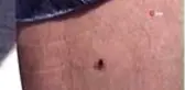 Uzmanından Kırım Kongo uyarısı