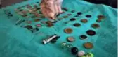 Çocukların midesinden çıkan onlarca yabancı cisim şaşırttı