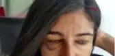 MUĞLA Bodrum'da 5 kadın böyle birbirine girdi, saldırıya uğrayan esnaf kadın o anları anlattı-2...