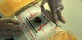 Doktor, Covid-19 geçirenlere seslendi: 