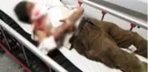 Misafirliğe gittiği evin köpeği yaşlı adamın önce yüzünü, sonra vücudunu parçaladı