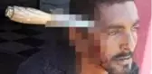 Tanımadığı biri tarafından kafasına bıçak saplanan adam, 3 gün sonra işe döndü
