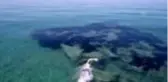 Diyabet ve çolyak hastası yüzücüden 