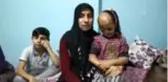 Bebekken yüzü yanan 5 yaşındaki Dilara ameliyat olmak için yardım bekliyor