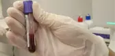'Genetik yatkınlık testi' ile kişilerin koronayı nasıl geçireceğini öğrenmek mümkün