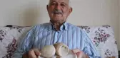 Mesanesinden 2,5 kilo taş çıktı, 