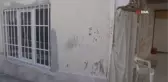 Hem evinden hem ayağından olma korkusuyla yaşıyor