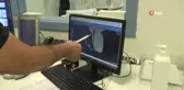 Bu yöntemle damar tıkanıklığının belirlenmesinde süre kısalıyor