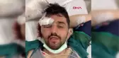 DENİZLİ Madendeki göçükte yaralanan işçi tedaviye alındı