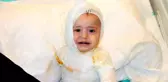 Üzerine kaynar süt dökülen 1 yaşındaki çocuk feci şekilde yandı