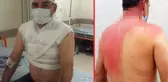 Sigara dumanı yüzünden tartıştığı komşusunun üzerine kaynar su döktü