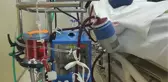 YAŞAMIN DURDUĞU NOKTADA ECMO TEDAVİSİYLE MUCİZE BAŞARIYORLAR