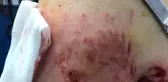 Sokak köpekleri genç kıza saldırdı
