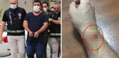 Kumar baskınında paraları kaptıran şüpheli, komiserin kolunu ısırdı