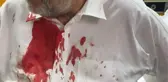 Son dakika haberi | St. Vincent ve Grenadinler Başbakanının kafasına protesto sırasında taş isabet etti