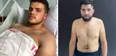 Altındağ'daki kavgada ağır yaralanan Ali yaşananları anlattı: Küfürlü konuşunca uyarmak istedik, tehdit edip bıçakla saldırdılar